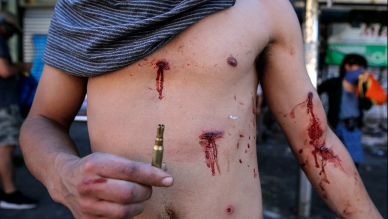 Chile: Ya son 15 los muertos por la represión y hay más de 200 heridos